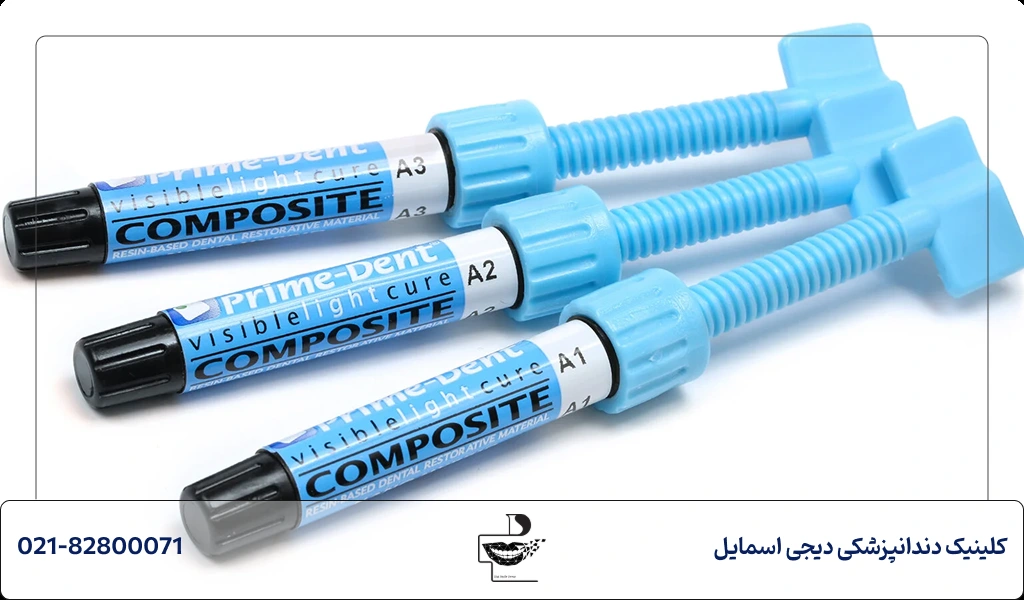 عوامل موثر بر طول عمر کامپوزیت دندان