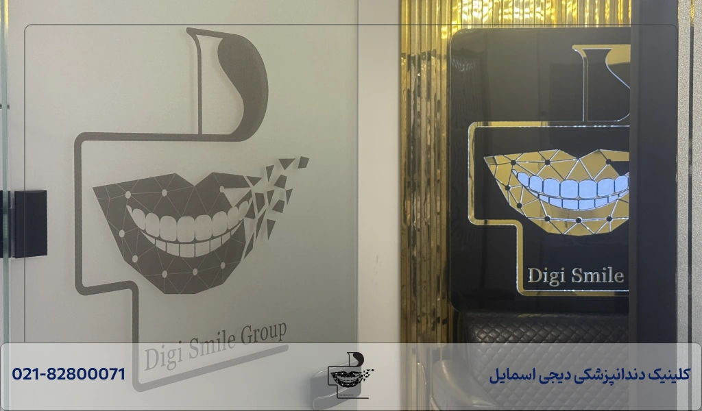 معرفی بهترین مرکز لمینت دندان در شمال تهران