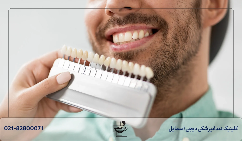 راه های جلوگیری و درمان عوارض کامپوزیت دندان